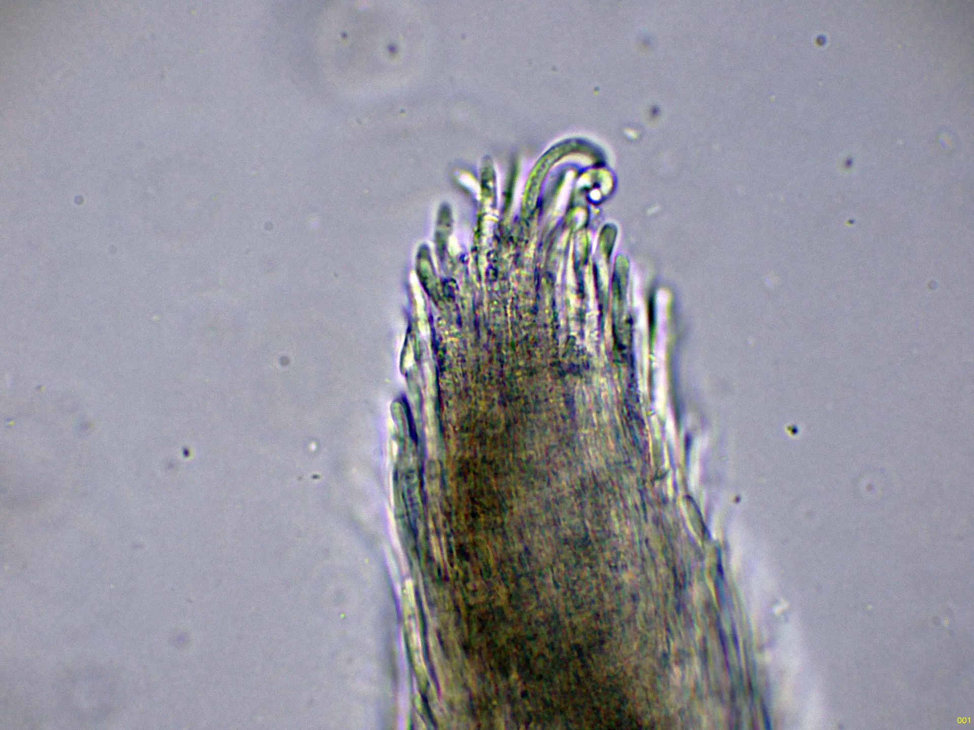 Microscopía de Mycoacia uda - 10 - Acúleos agua -001